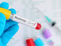 إسبانيا ترصد أول إصابة مشتبه بها بفيروس ماربورج